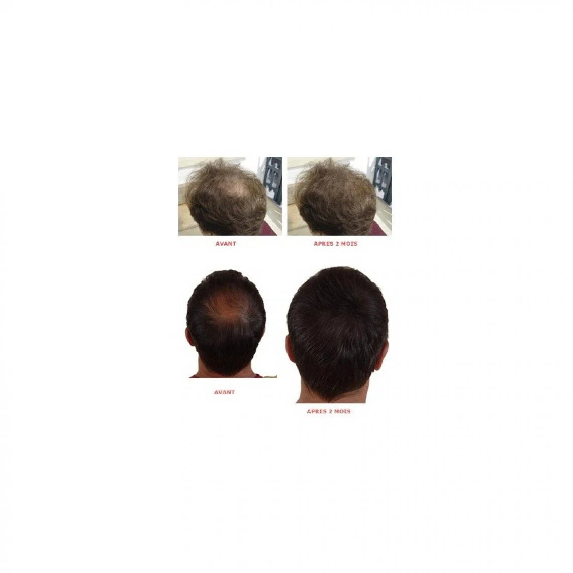 Claude Bell Hair Force One Lotion Tonifiante Anti-Chute 3 Claude Bell Hair Force One Lotion Tonifiante Anti-Chute