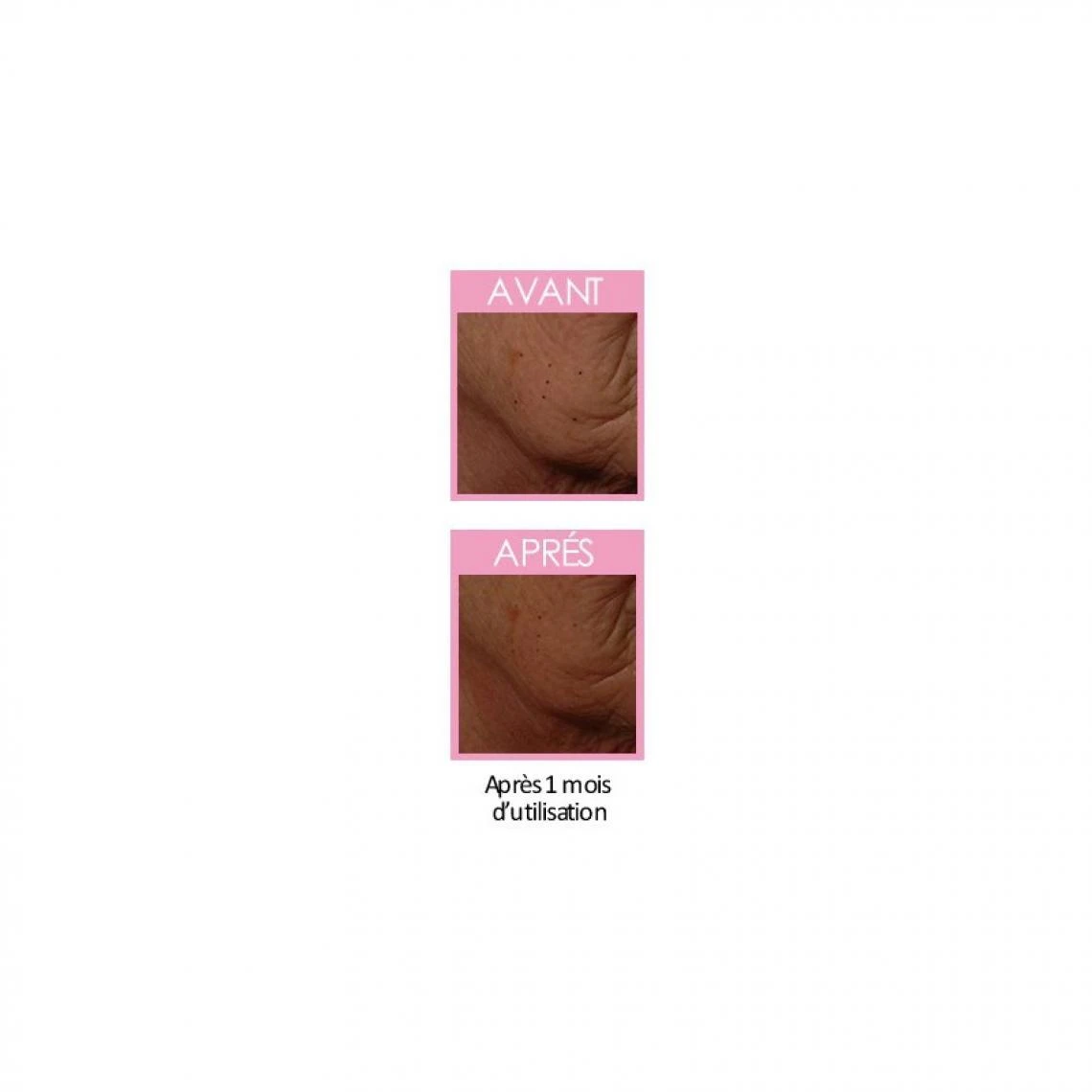 Claude Bell S.R.J.9 Soin Restructurant Des Joues Femme 6 Claude Bell S.R.J.9 Soin Restructurant Des Joues Femme – Image 4